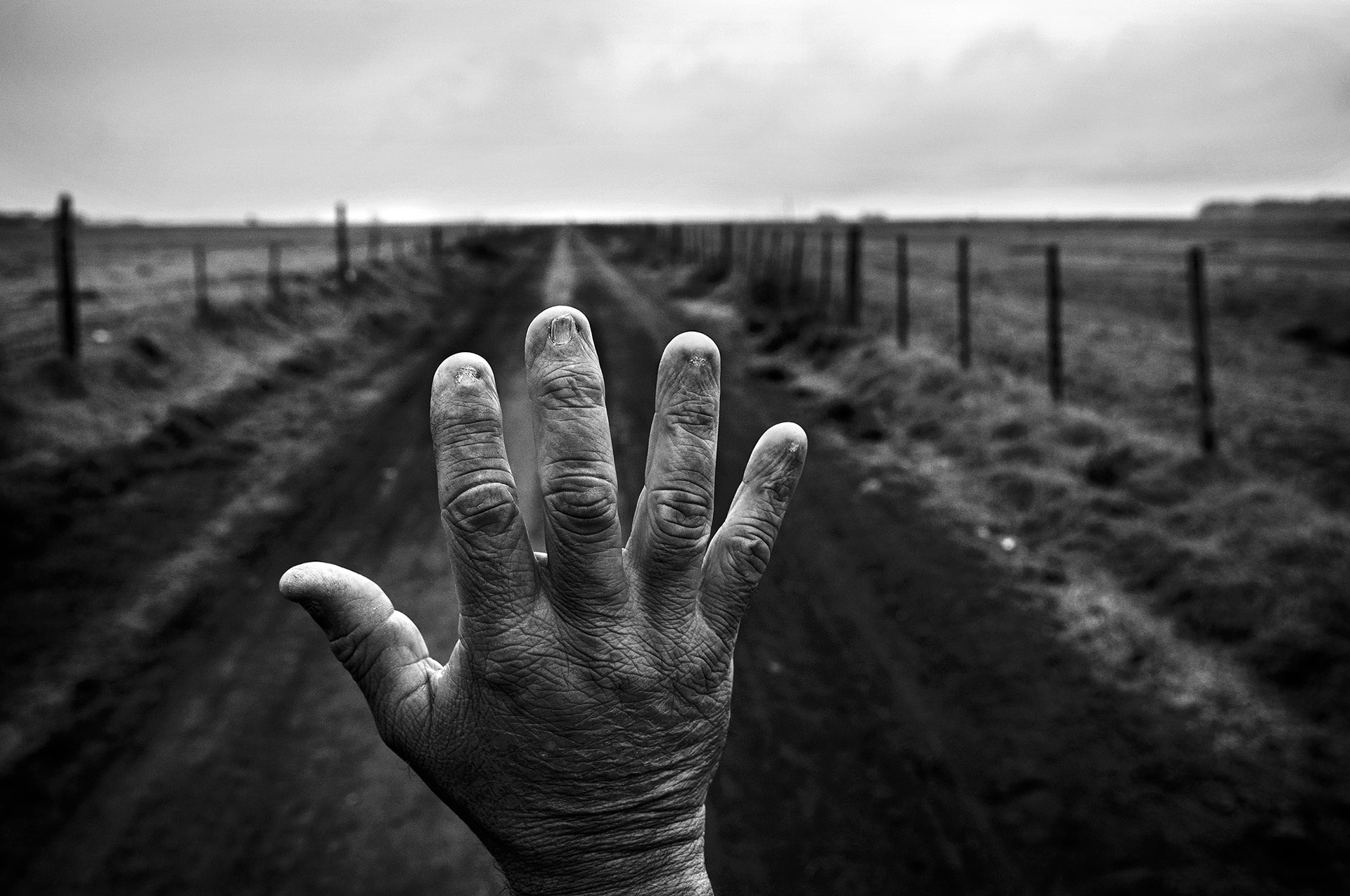 23/9/2015. Monte Maíz, Provincia de Córdoba, Argentina. Alfredo Cerán trabajó durante nueve años como fumigador, tratando con productos químicos las plantaciones de soja. Se le quemaron las uñas. Los resultados de sus análisis de sangre muestran residuos de sustancias como el glifosato, el clorpirifós, la azatrina, el 2.4-D y la cipermetrina.
