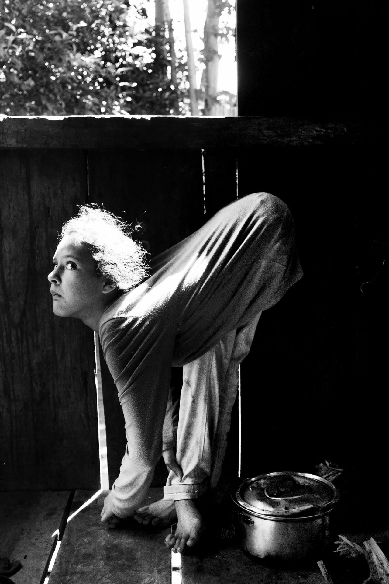 7-4-2015. Fracrán, Provincia de Misiones. Desde los 7 años, Jesica Sheffer (actualmente 11) sufre una malformación de los tendones que le impide estar erguida. Fracrán es una zona productora de tabaco con un alto índice de incidencia de personas afectadas por los agrotóxicos. En la provincia de Misiones, cinco de cada mil niños o niñas nacen con mielomeningocele (MMC), una grave malformación del sistema nervioso central. Nacen con espina bífida, lo cual les provoca incontinencia urinaria y fecal y problemas en los miembros inferiores.