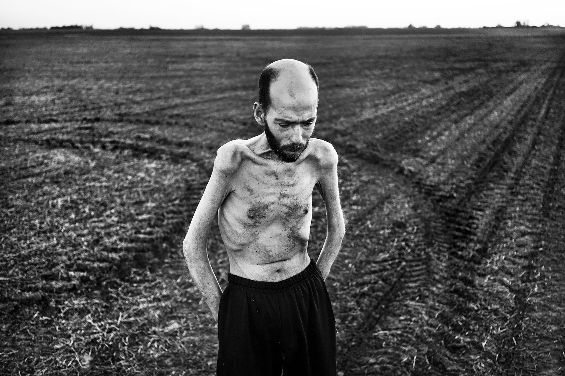 29-10-2016. Entre Ríos, Argentina. Fabián Tomasi trabajó durante años para una compañía de fumigación aérea, cargando y bombeando productos químicos. Sufre una neuropatía tóxica severa y actualmente está en tratamiento por atrofia muscular general, lo que le obliga a guardar cama. Fabián se ha convertido en un ejemplo viviente del impacto de los agrotóxicos en la salud humana. Dedica su vida a la sensibilización sobre este problema.