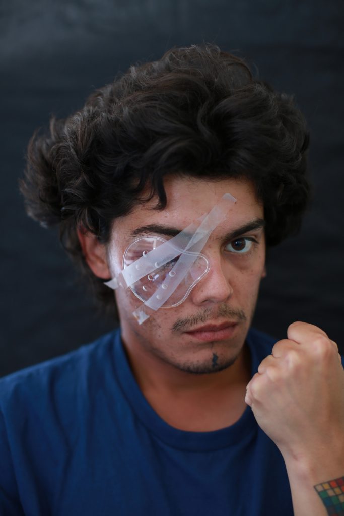 Camilo Gálvez (24) maquinista de profesión y dueño de una página en redes sociales como thetravel antü. "Nunca he participado de ninguna marcha, quedé atrapado en medio de la protesta, frente al centro cultural GAM. Tengo el ojo comprometido y no tengo visión. Estoy esperando por mi segunda operación”.