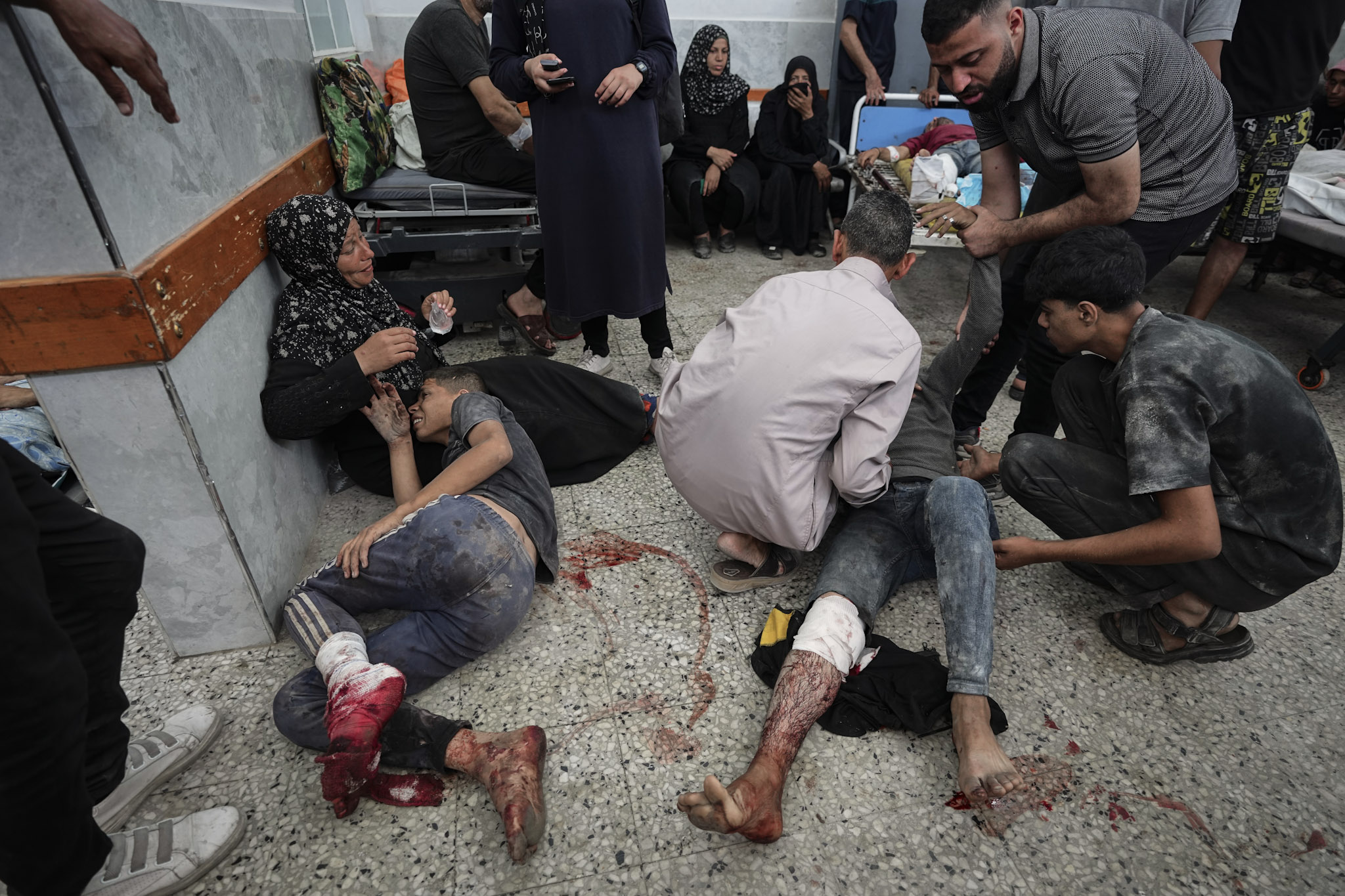 Algunos palestinos son trasladados al hospital Shifa de la ciudad de Gaza tras resultar heridos cuando se dirigían a un centro de distribución de ayuda, el jueves 3 de julio de 2025.